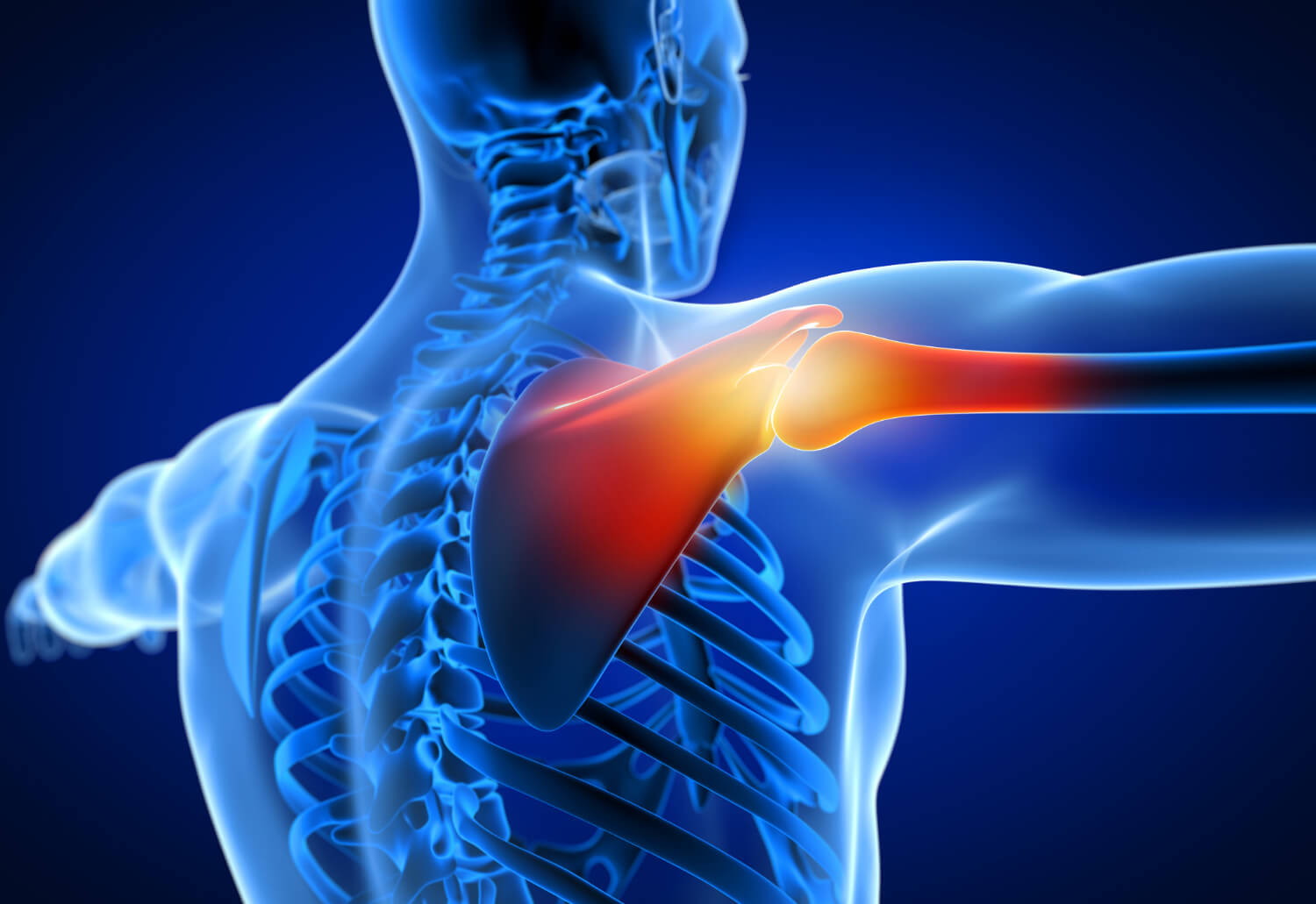 5 Conditions That Cause Lasting Shoulder Pain - Nortex